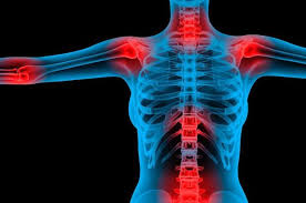 dor fibromialgia costas articulações