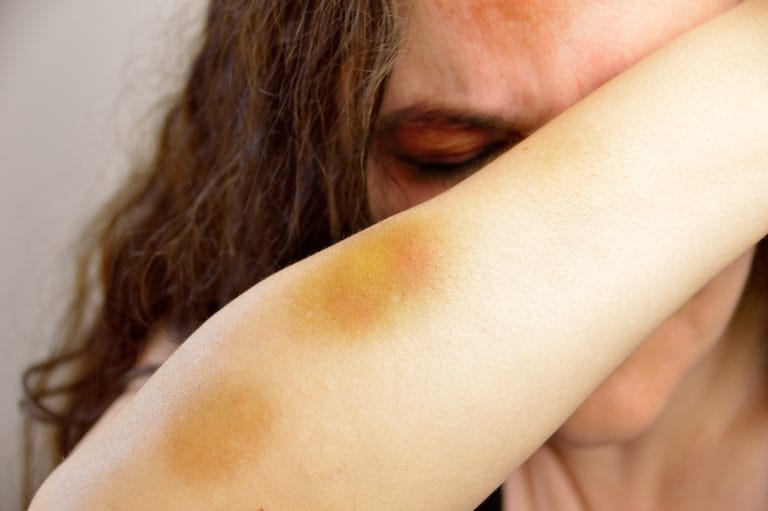 Segurança - violência doméstica - mulher - mulheres - Lei Maria da Penha