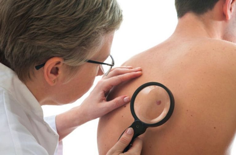 Saúde - doenças - câncer de pele exames consultas médicos pacientes dermatologistas