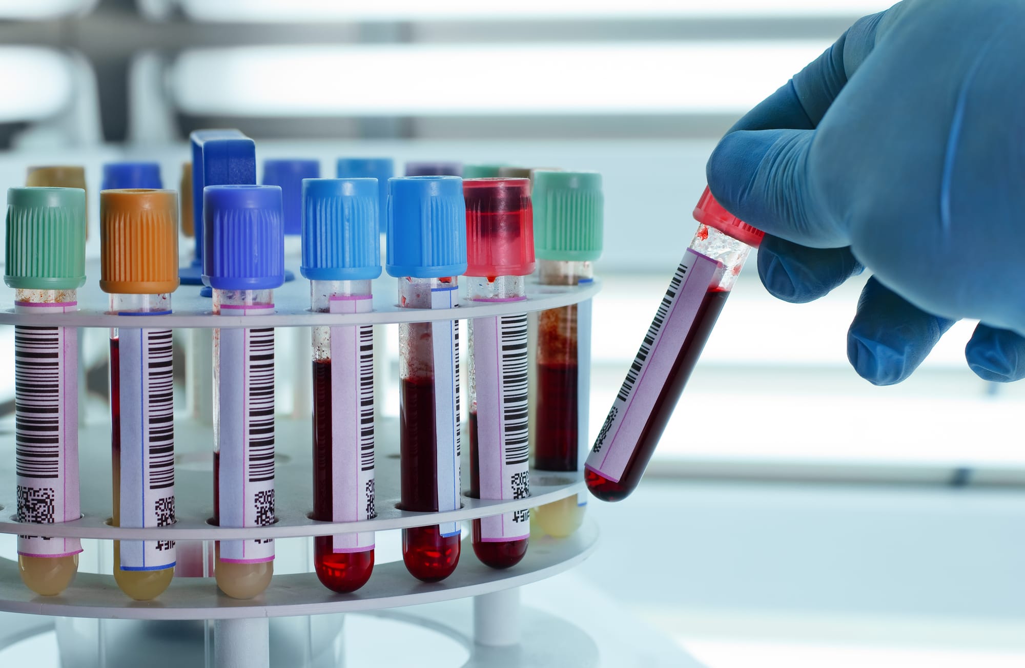 Saúde - geral - sangue - exame de sangue - laboratório Saúde - geral - sangue - exame de sangue - laboratório