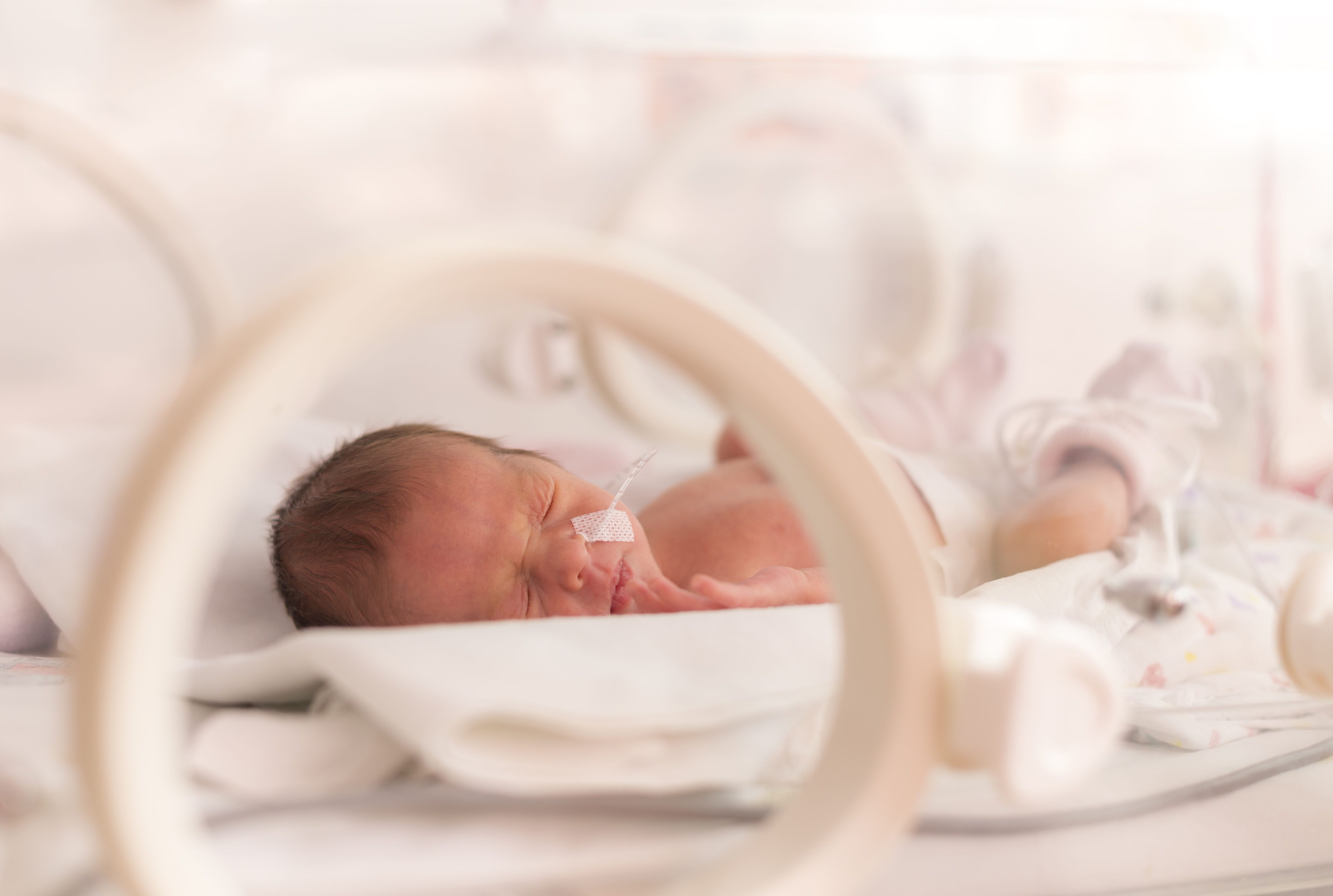 Saúde - geral - bebê prematuro - UTI Neonatal - bebês internados após parto precoce