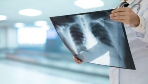 Comissão debate a formulação de políticas públicas para pessoas com hipertensão pulmonar crônica