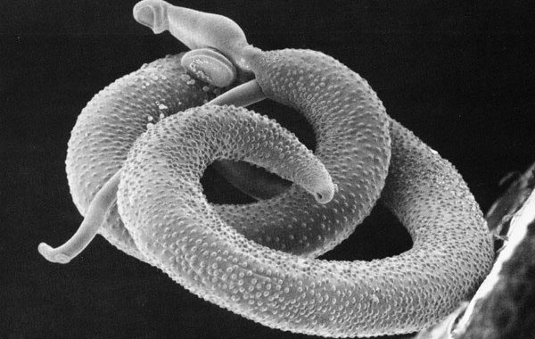 Estudo mapeia potenciais alvos genéticos contra a esquistossomose