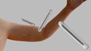 Projeto reforça proibição de implantes hormonais para fins estéticos