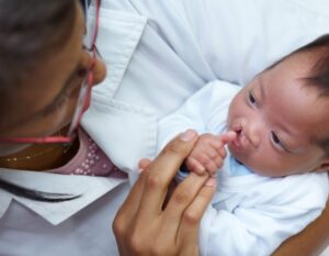 Comissão aprova apoio psicológico a responsáveis por pacientes com fissura labiopalatina