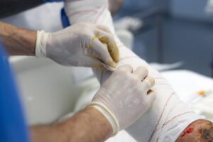 Projeto garante assistência integral e cirurgias reparadoras para vítimas de queimaduras
